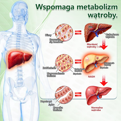 Moauou® Moringa × Berberyna × AMPK 10-w-1 Wsparcie metaboliczne, plaster z nanotechnologią mikroigłową  (Wystarczy raz dziennie, widoczne efekty w 7 dni) ✅ Na otyłość, wiotką skórę, cukrzycę, bezdech senny, problemy ze stawami i wiele innych 🔥