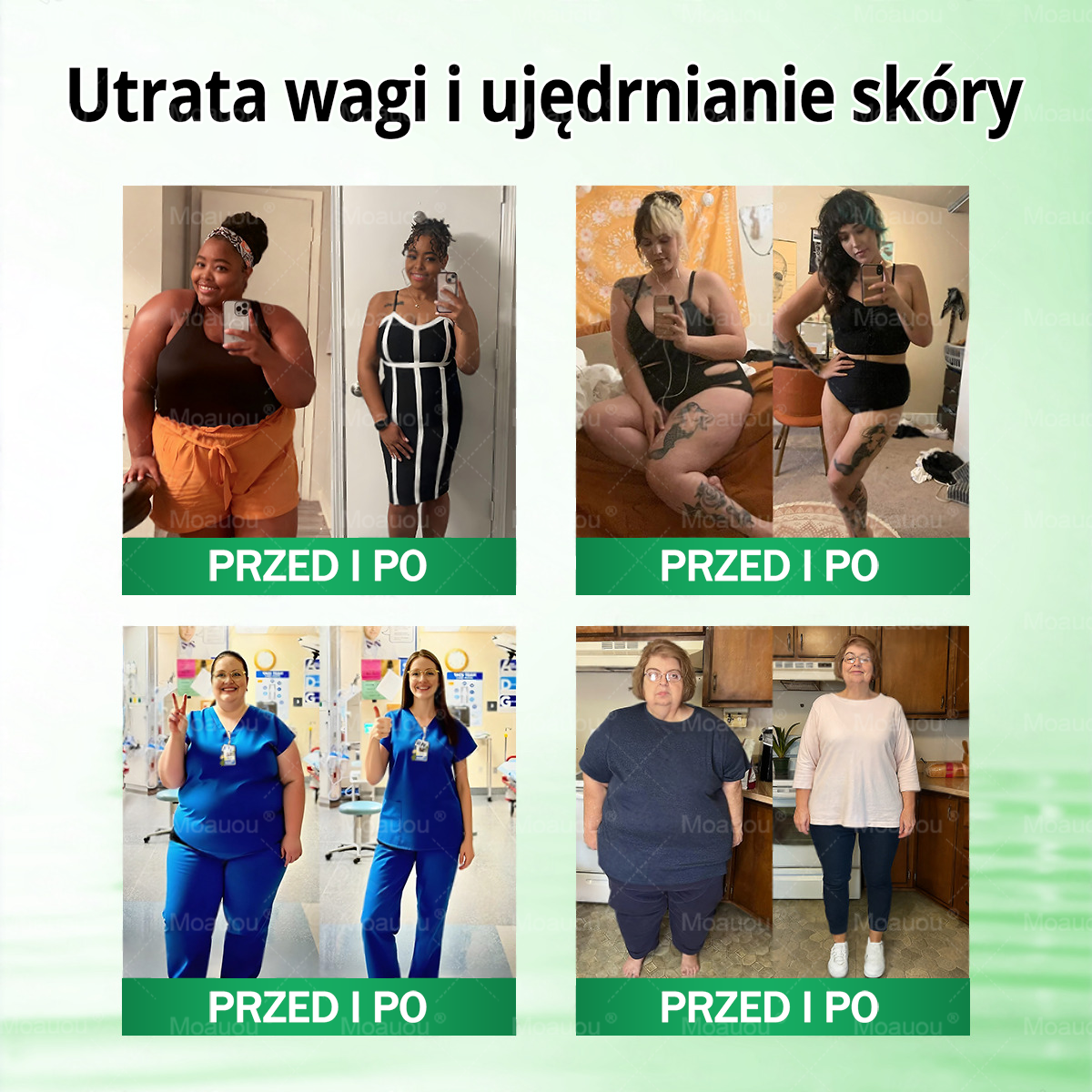 Moauou® Moringa × Berberyna × AMPK 10-w-1 Wsparcie metaboliczne, plaster z nanotechnologią mikroigłową  (Wystarczy raz dziennie, widoczne efekty w 7 dni) ✅ Na otyłość, wiotką skórę, cukrzycę, bezdech senny, problemy ze stawami i wiele innych 🔥