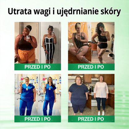 Moauou® Moringa × Berberyna × AMPK 10-w-1 Wsparcie metaboliczne, plaster z nanotechnologią mikroigłową  (Wystarczy raz dziennie, widoczne efekty w 7 dni) ✅ Na otyłość, wiotką skórę, cukrzycę, bezdech senny, problemy ze stawami i wiele innych 🔥